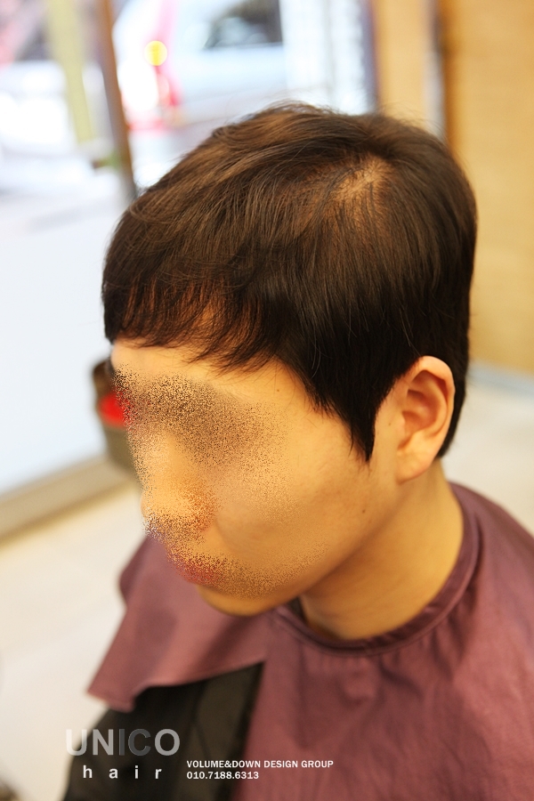 20대 머리숱 없는 남자 헤어 탈모 헤어스타일(가늘고 힘없는 머리 스타일) : 네이버 블로그
